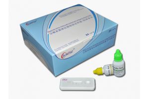 沙眼衣原体检测试剂生产厂家上海凯创生物 沙眼衣原体检测试剂生产厂家上海凯创生物