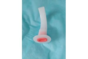 一次性使用口咽通气道 一次性使用口咽通气道