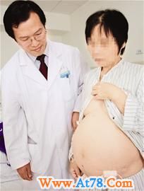 妇女“生下”40斤肉团 曾被多家医院判死刑(图)