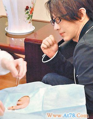 刘谦在家割伤手“魔指”险废掉(图)