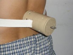 招代理艾灸器艾灸腰椎病