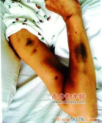 湖北厅官妻子遭警察围殴16分钟 公安称打错了