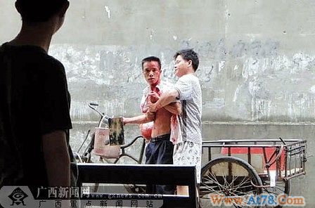 因小事动拳脚头被打伤 “飙血哥”走红网络