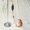 小儿头部静脉输液模型,高级婴儿头部双侧静脉注射穿刺训练模型