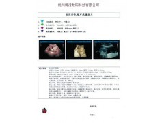 供应,希龙牌,医用激光彩色打印胶片 供应,希龙牌,医用激光彩色打印胶片