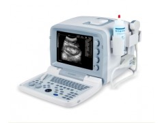 凯信便携式 B超机价格KX2000(H)全数字B型超声诊断仪