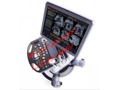 高端专业妇产科VOLUSON S8四维多普勒彩色超声诊断仪 高端专业妇产科VOLUSON S8四维多普勒彩色超声诊断仪